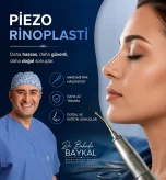 Op. Dr. Bahadır Baykal tarafından uygulanan piezo rinoplasti ile doğal ve hassas burun estetiği.